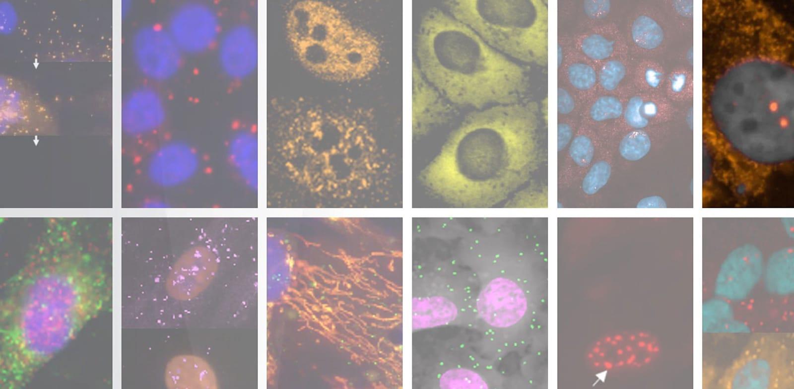 מתוך המערכת שצובעת תאים ומגלה אם הם בריאים / צילום: באדיבות אנימה מתוך המערכת שצובעת תאים ומגלה אם הם בריאים / צילום: באדיבות אנימה