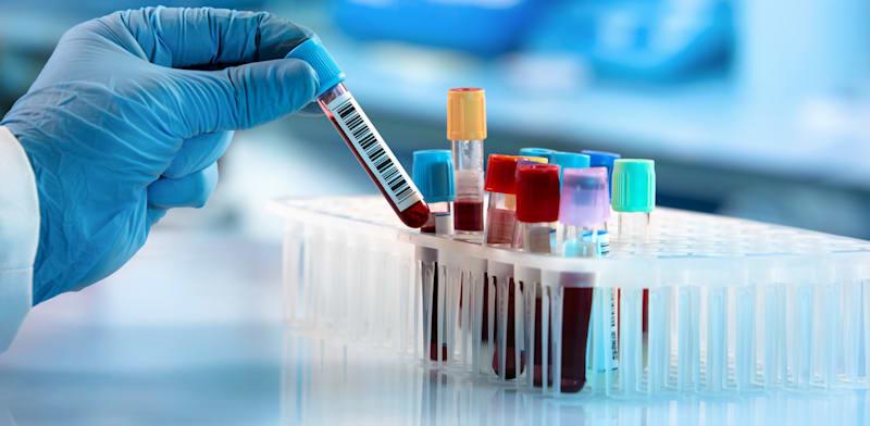 צילום: ת מעבדה - קרוב לבית ותוצאות במקום / אילוסטרציה: Shutterstock צילום: ת מעבדה - קרוב לבית ותוצאות במקום / אילוסטרציה: Shutterstock