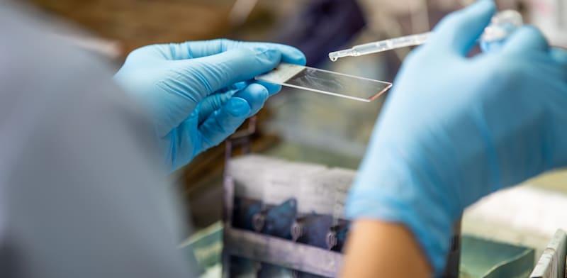 צילום: יפול שפותח לסרטן יוביל למהפכה במחלות נוספות? / אילוסטרציה: Shutterstock צילום: יפול שפותח לסרטן יוביל למהפכה במחלות נוספות? / אילוסטרציה: Shutterstock